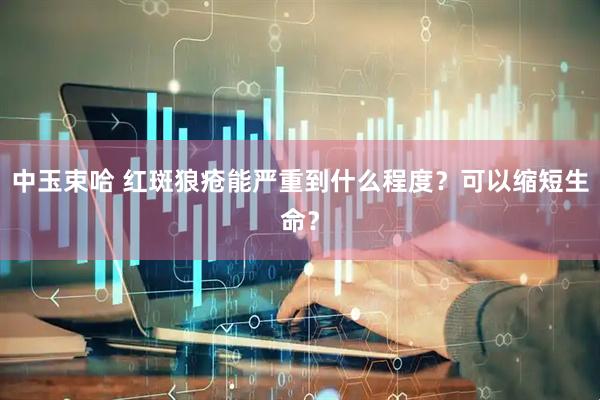 中玉束哈 红斑狼疮能严重到什么程度？可以缩短生命？